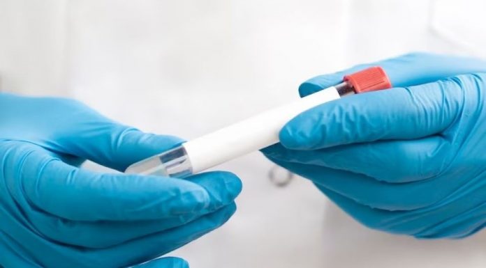 Totul despre testul TSH: de ce e important si cand ar trebui sa-l faci